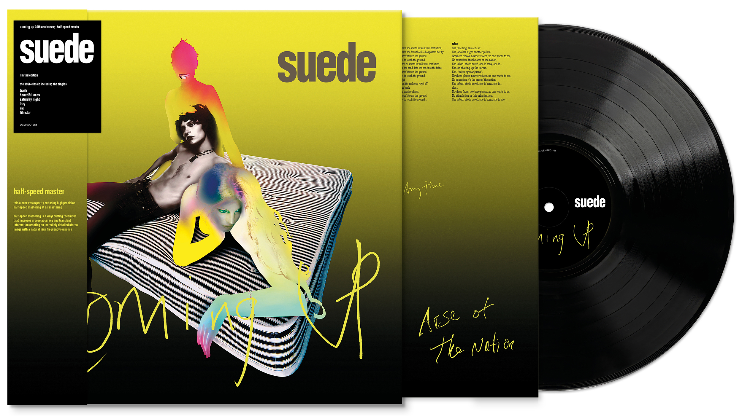 TVD Radar: Suede, Coming Up 30th anniversary 1LP, 5CD reissue in